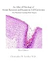 Dermatologic Surgery Skin Cancer and Mohs Surgery- An Atlas of Histology of Actinic Keratosis and Squamous Cell Carcinoma (For Physicians Learning Mohs Surgery)