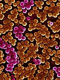 MRSA Infections Occur Most Frequently in Hospitals and Healthcare Photographic Poster Print, 12x16