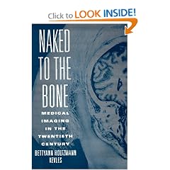 Naked to the Bone: Medical Imaging in the Twentieth Century (Sloan Technology Series)