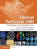 Clinical perfusion MRI : techniques and applications