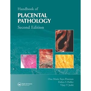 Click here to buy Handbook of Placental Pathology by Ona Marie Faye-Petersen, Debra S. Heller, and Vijay V. Joshi.