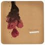 Radiotherapy