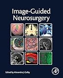 Image-guided neurosurgery