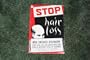 STOP HAIR LOSS; NEW SWEDISH DISCOVERY...