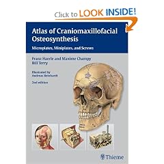 Atlas of Craniomaxillofacial Osteosynthesis: Microplates, Miniplates, and Screws by Franz Haerle, Maxime Champy and Bill Terry