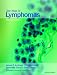 Book Text Atlas of Lymphomas