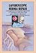 Hernia Repair, Laparoscopic