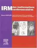Irm de malformations cardiovasculaires