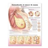 Understanding Breast Cancer Spanish: Entendiendo el cáncer de mama