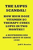 THE LUPUS SCANDAL!! HOW A HORRIFYING DISEASE CAN BE EASILY CURED IN 7 WEEKS WEEKS WITH HIGH DOSES OF VITAMIN D3