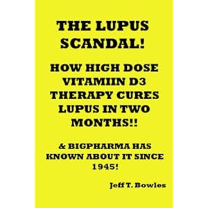 THE LUPUS SCANDAL!! HOW A HORRIFYING DISEASE CAN BE EASILY CURED IN 7 WEEKS WEEKS WITH HIGH DOSES OF VITAMIN D3