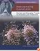 Prostate Cancer: Current And Emerging Trends In Detection And Treatment (Cancer and Modern Science)