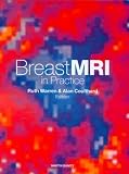 Breast MRI in Practice