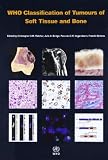 WHO Classification of Tumours of Soft Tissue and Bone (World Health Organization Classification of Tumours)