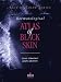 Book Dermatological Atlas of Black Skin (Skin of Color)