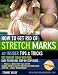 How to Get Rid of Stretch Marks - 40 Insider Tips & Tricks;The Ultimate Guide on How to Remove Stretch Marks. Get Rid of Pregnancy Stretch Marks by Using Little Known Home Remedies!