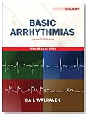 Basic Arrhythmias, 7th Edition