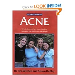 Acne: The at Your Fingertips Guide