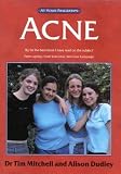 Acne: The at Your Fingertips Guide (At Your Fingertips)