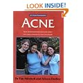 Acne: The at Your Fingertips Guide
