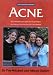 Acne: The at Your Fingertips Guide