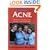 Acne: The at Your Fingertips Guide