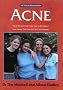 Acne: The at Your Fingertips Guide