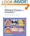 Clinical Cases in Prosthodontics