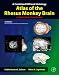 A Combined MRI and Histology Atlas of the Rhesus Monkey Brain in Stereotaxic Coordinates, Second Edition