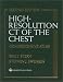 High-Resolution CT of the Chest: Comprehensive Atlas