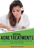 Natural Acne Treatments