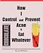 How I Control and Prevent Acne & Eat Whatever