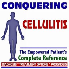 Click here to buy 2009 Conquering Cellulitis - The Empowered Patient's Complete Reference - Diagnosis,... by PM Medical Health News.
