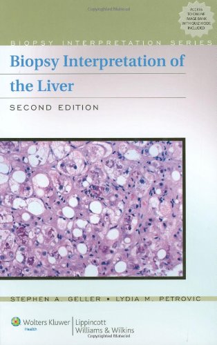 biopsy interpretation of the liver biopsy interpretation series