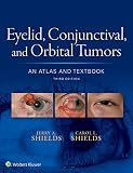 Eyelid, conjunctival, and orbital tumors : an atlas and textbook