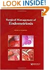 Surgical Management of Endometriosis