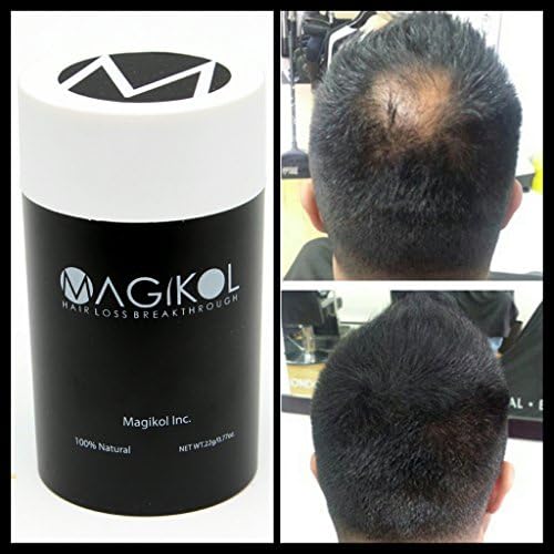 THE BEST RATED 100% Vegan + Natural Hair Loss Treatment for Men &amp; Women - 100% Money-Back Guarantee, Hair Building Fibers, Concealer, prevention, Make Thinning Hair Thickener - Magikol® 4 Week Supply