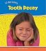 Tooth Decay (It's Not Catching)