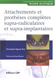 Attachements et proth�ses compl�tes supra-radiculaires et supra-implantaires