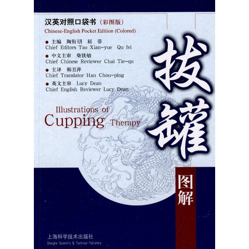 Illustrations of Cupping Therapy (Chinese-English Pocket Edition, Colored) (English and Chinese Edition)