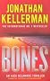 Bones