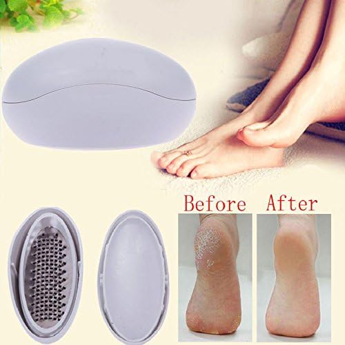 Egg Shape Pedicure Foot Care File Foot Callous Remove Ultimate Massage