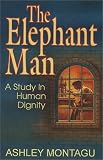 The Elephant Man : A Study in Human Dignity