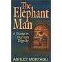 The Elephant Man : A Study in Human Dignity
