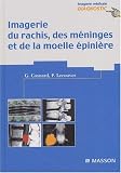 Imagerie du rachis, des m�ninges et de la moelle �pini�re