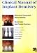 Clinical Manual of Implant Dentistry