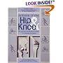 Arthritis of the Hip and Knee: The Active Person's Guide to Taking Charge