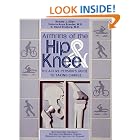 Click here to buy Arthritis of the Hip and Knee: The Active Person's Guide to Taking Charge by Ronald J. Allen, S. David Stulberg, and Victoria Anne Brander.