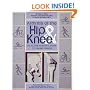 Arthritis of the Hip and Knee: The Active Person's Guide to Taking Charge
