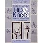 Arthritis of the Hip and Knee